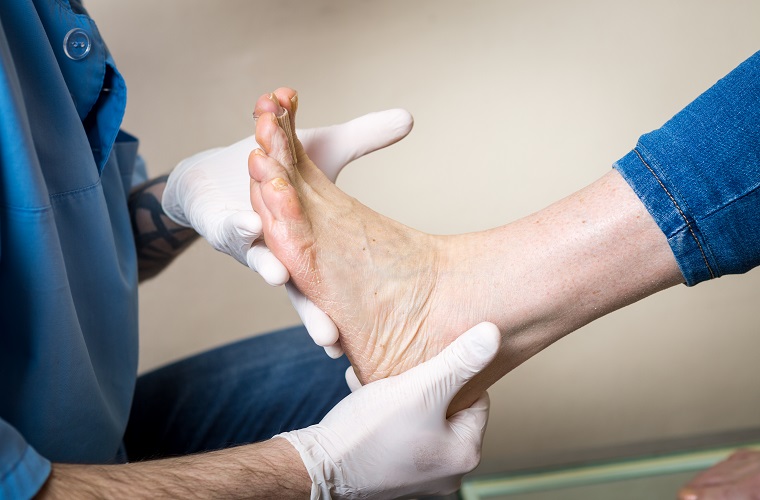 Should I See a Physio or a Chiropodist for Plantar Fasciitis